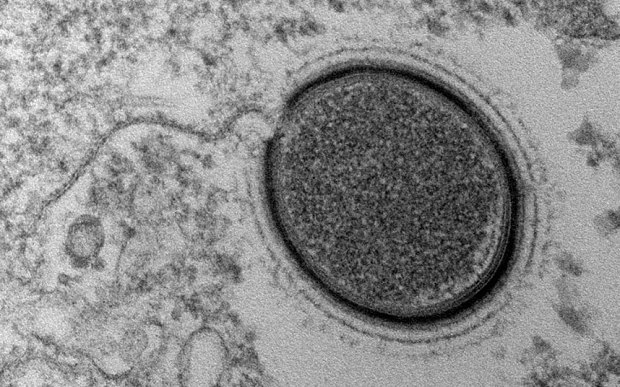 30,000 year old giant virus uncovered by scientists